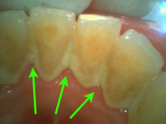 スケーリング前