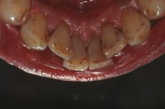 スケーリング後